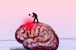 Headaches & Migraines