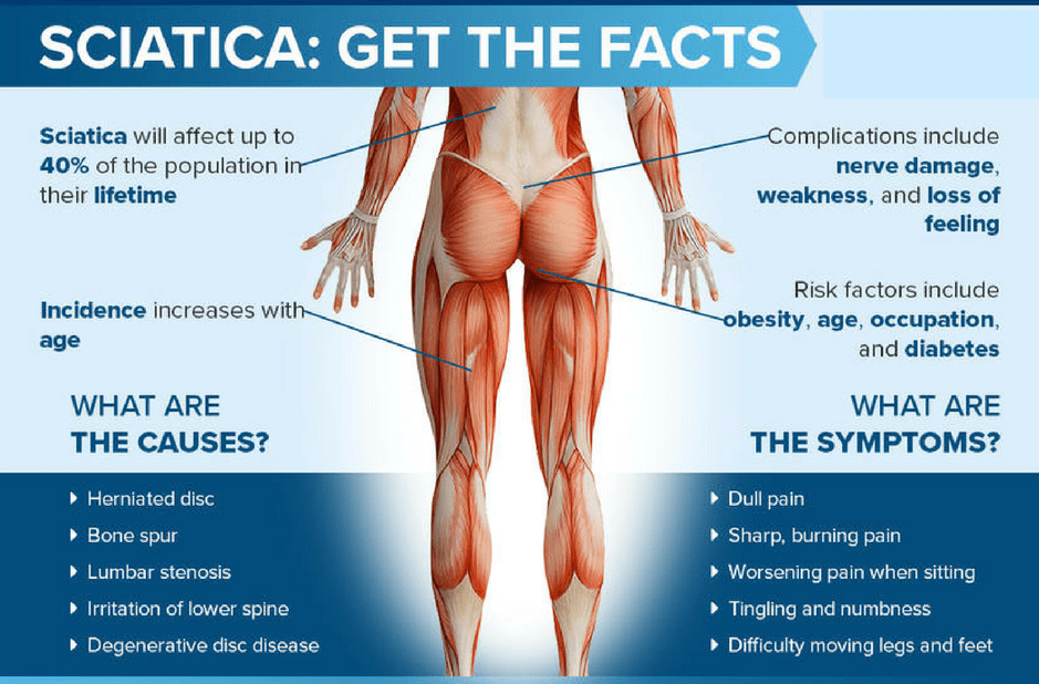 Sciatica Treatment